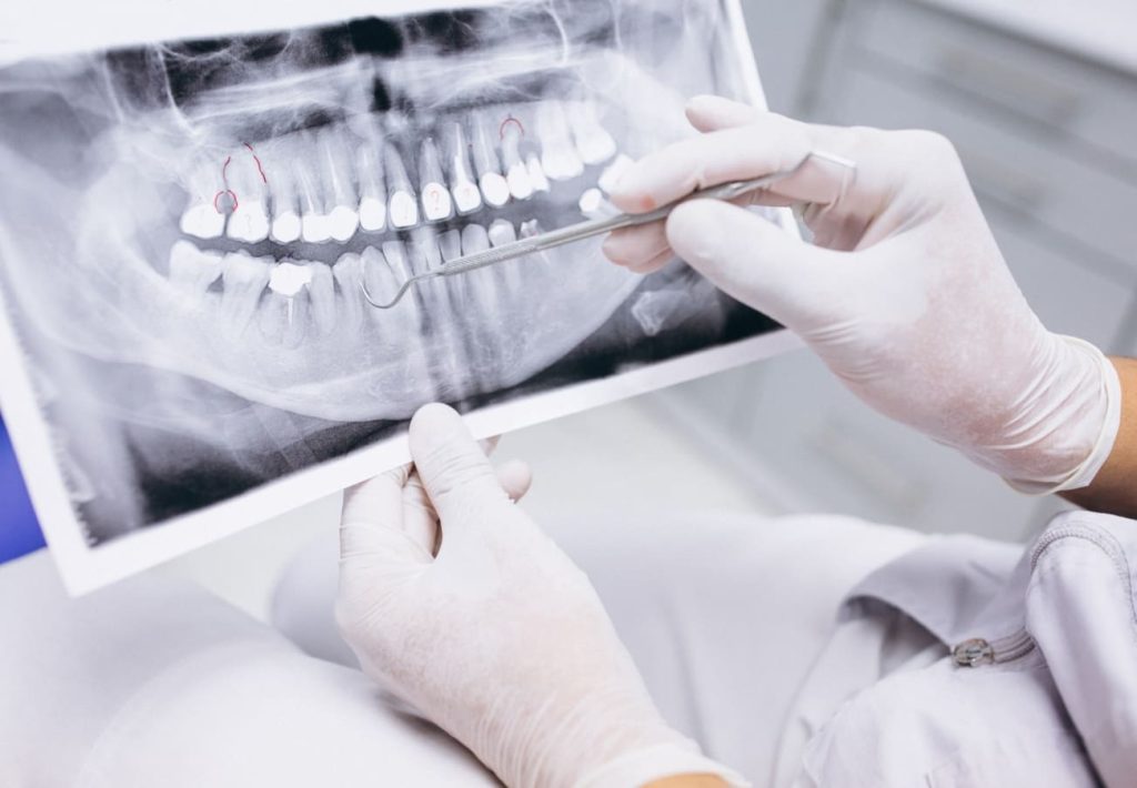Studio Anglesio Farina | Endodonzia