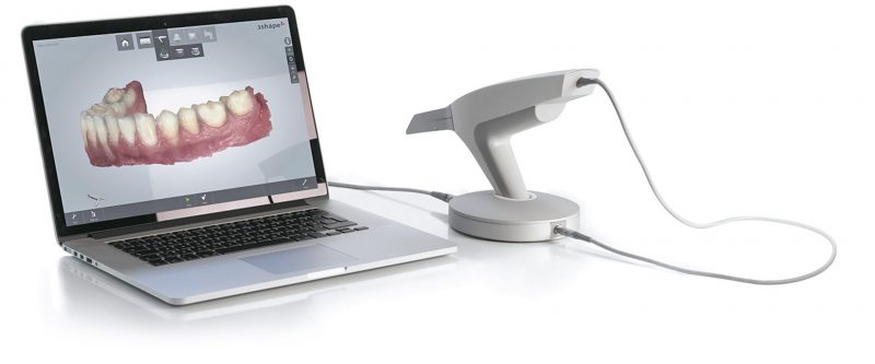 scanner-intraorale-_image